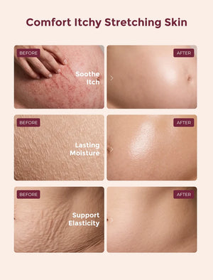 Momcozy Pro-Collagen Belly Firming Moisturizer Stretch Mark Cream - Pro-Collagen krem gegn slitförum
