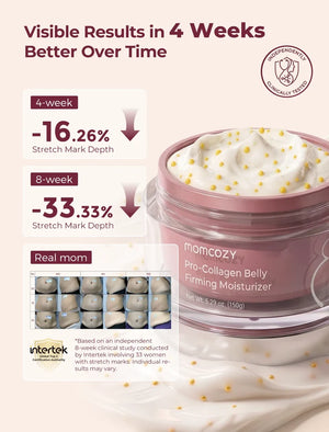 Momcozy Pro-Collagen Belly Firming Moisturizer Stretch Mark Cream - Pro-Collagen krem gegn slitförum